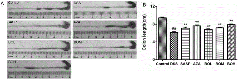 Application of oleum fructus bruceae in preparation of medicines for treating ulcerative colitis