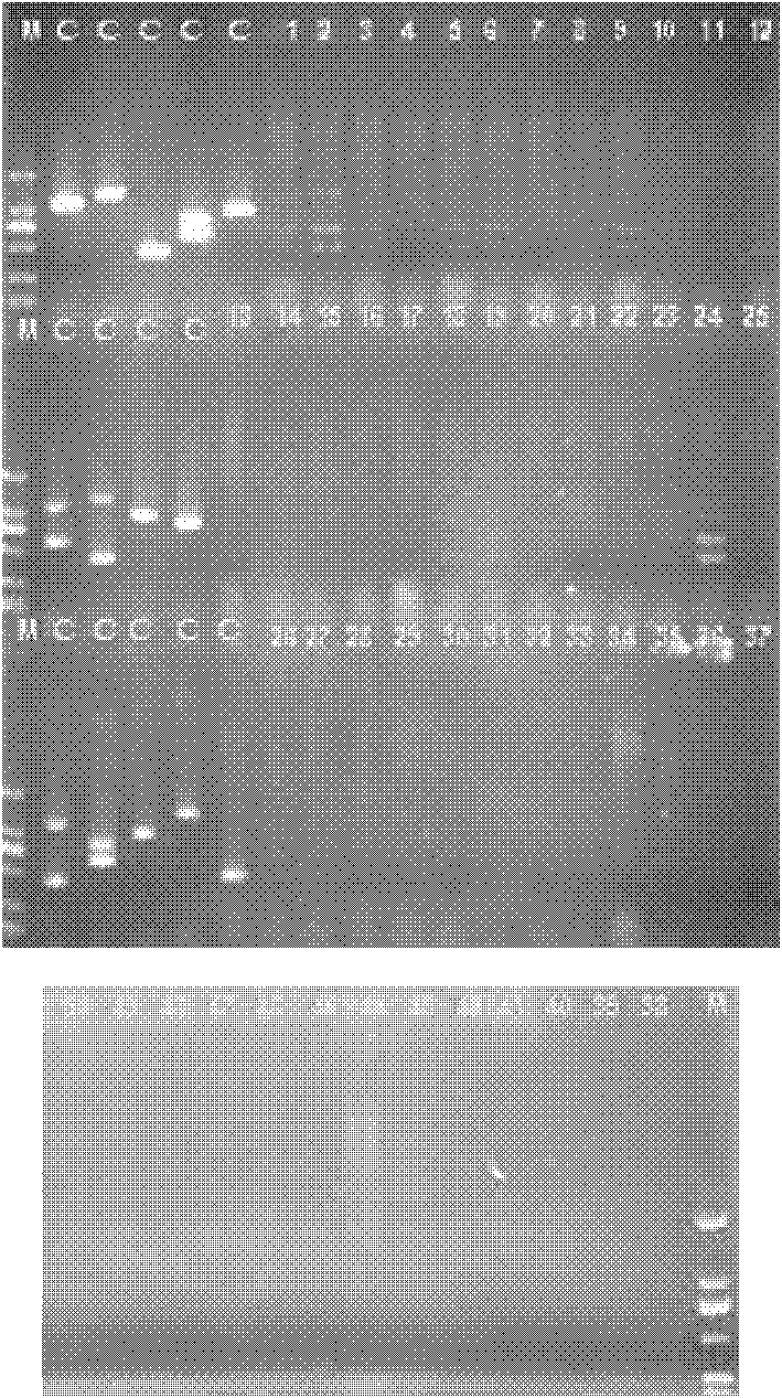 Primer for detecting serotype of shigella flexneri and multiplex amplification using same