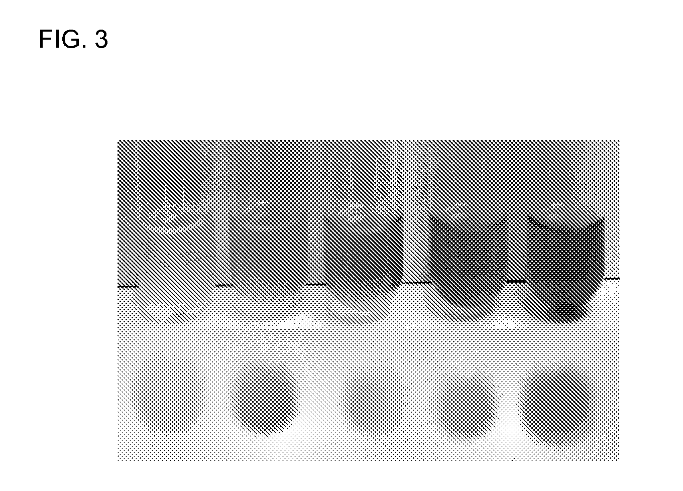 Therapeutic Applications of Aminolevulinate Synthase