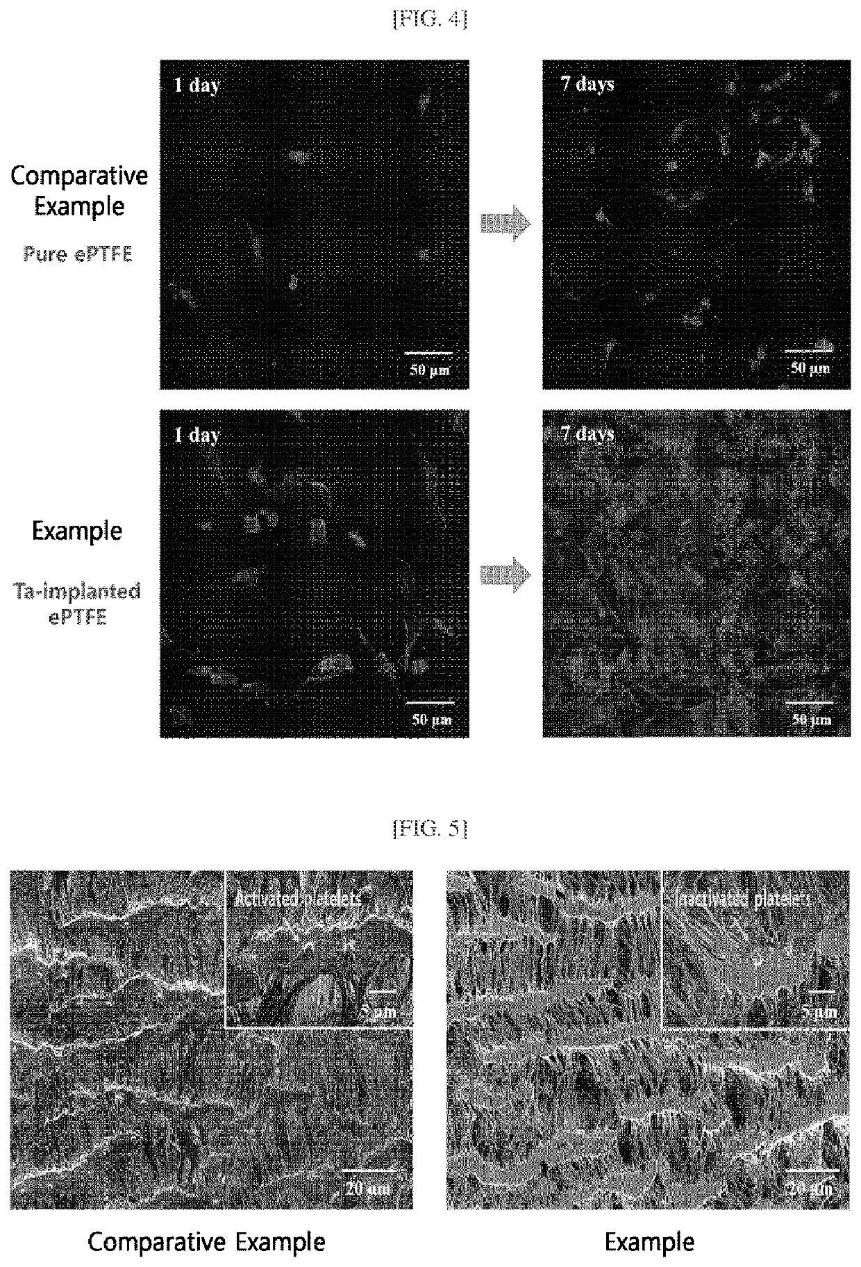 METHOD OF MANUFACTURING ePTFE ARTIFICIAL VASCULAR GRAFT WITH IMPROVED BLOOD COMPATIBILITY BY SELECTIVE PLASMA ETCHING