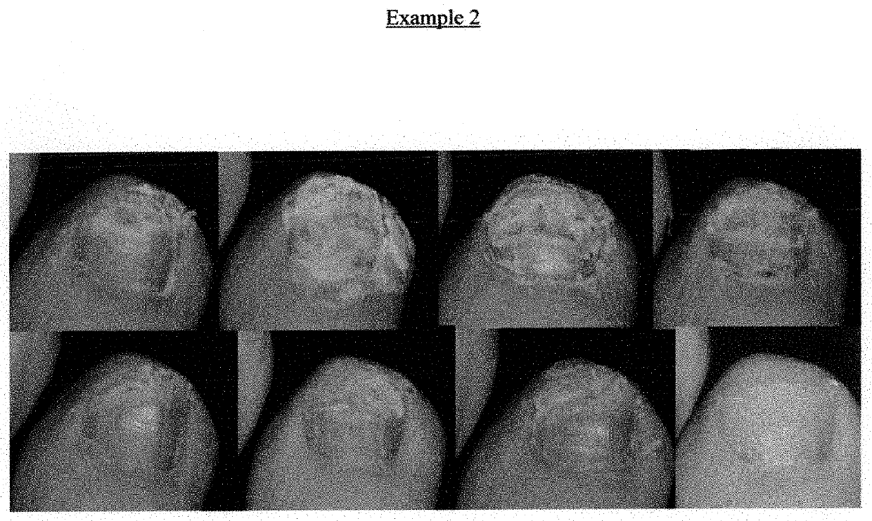 Treatment Methods and Processes for an Infected Nail