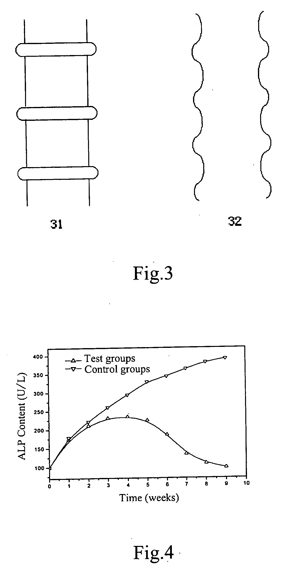 Biodegradable common bile duct stent and the method for preparaing thereof