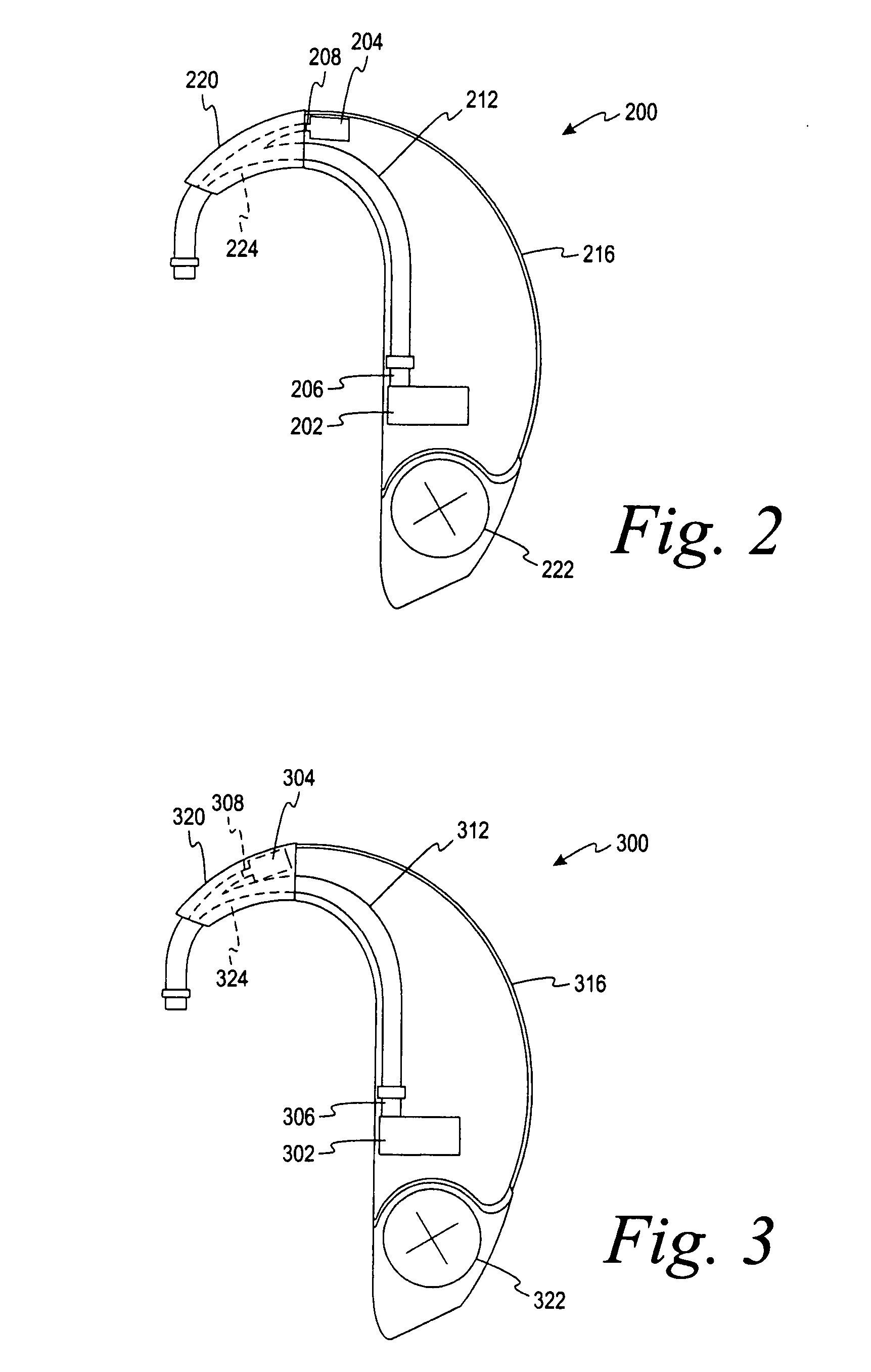 Hearing aid having two receivers each amplifying a different frequency range