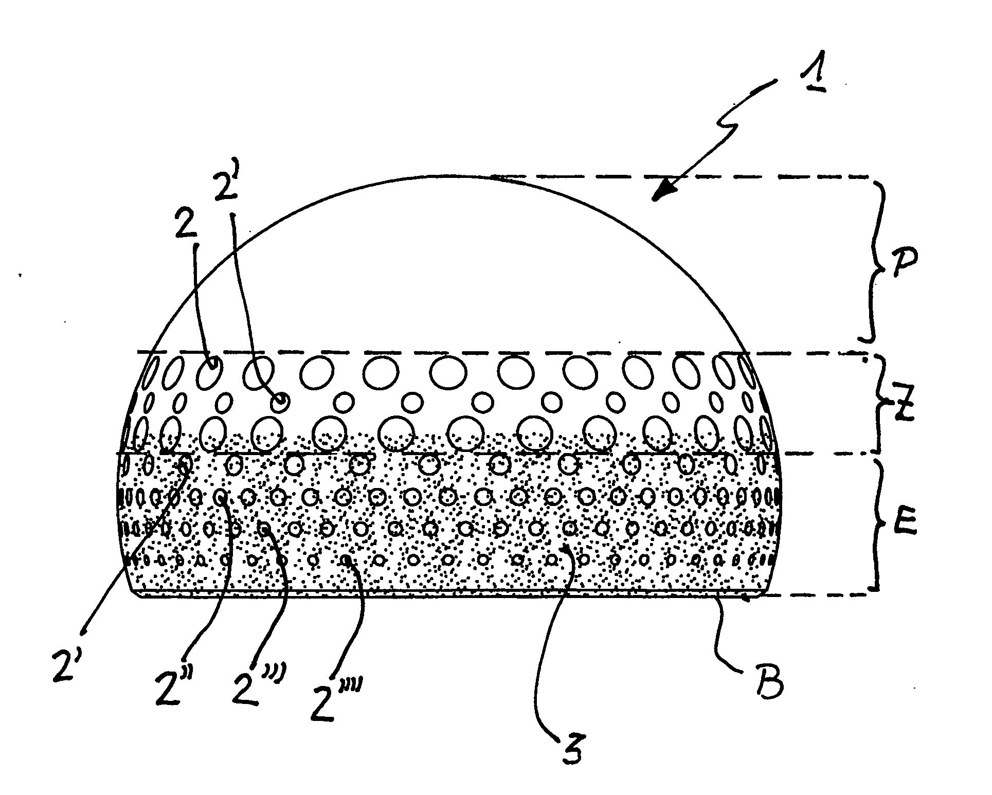 Ball joint or cap implant for an artificial hip joint