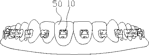 Orthodontic tray and manufacturing method thereof