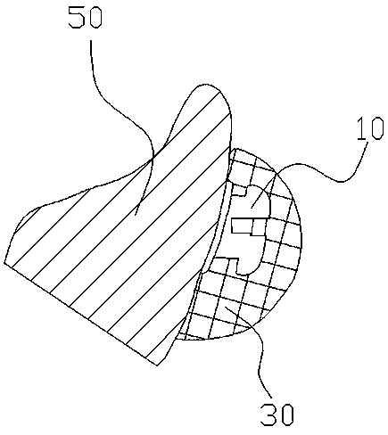 Orthodontic tray and manufacturing method thereof