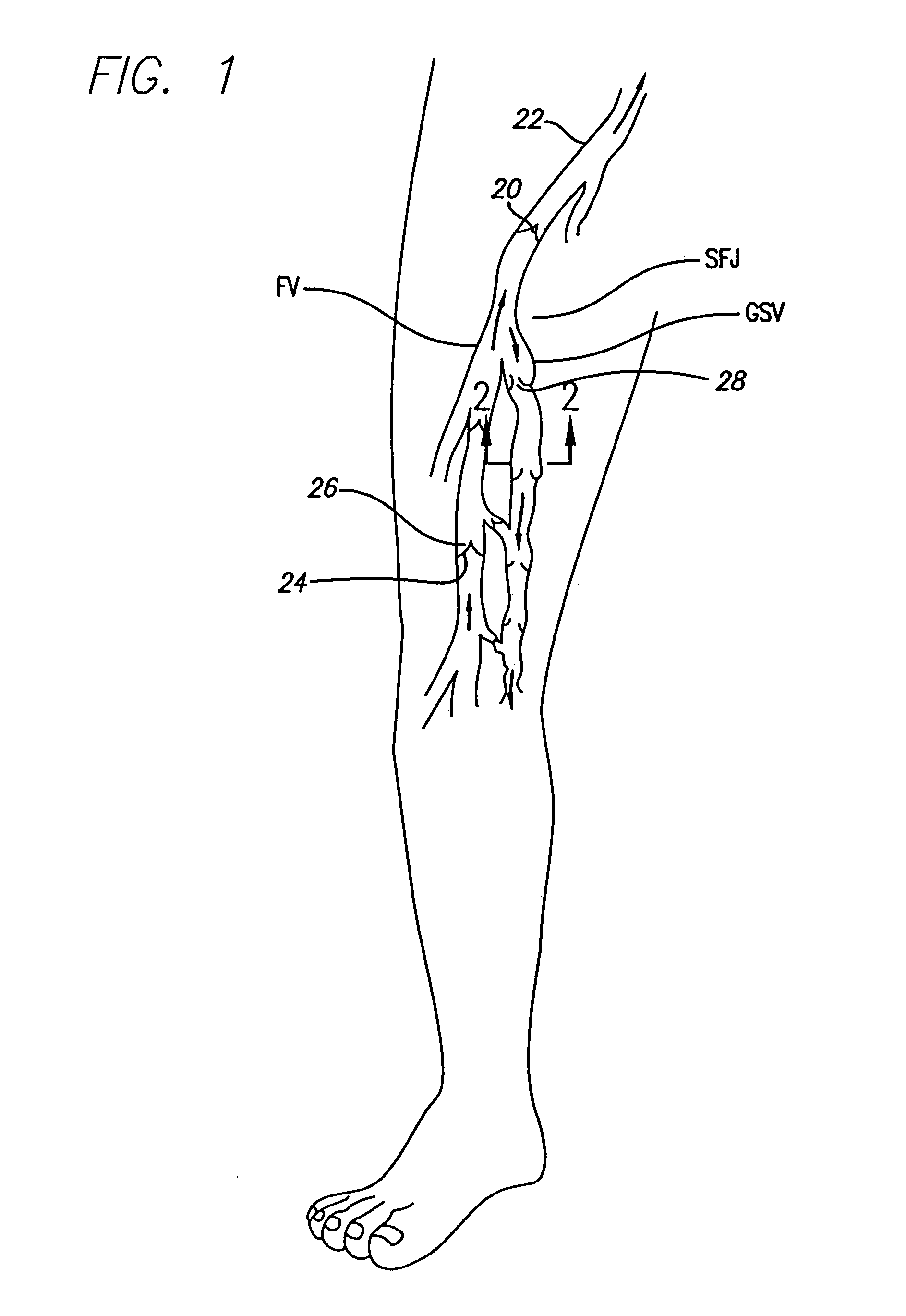 Method and apparatus for positioning a catheter relative to an anatomical junction