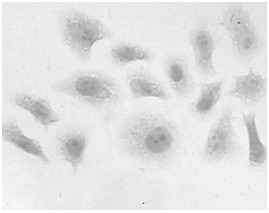 Non-small cell lung cancer (NSCLC) marker and its application