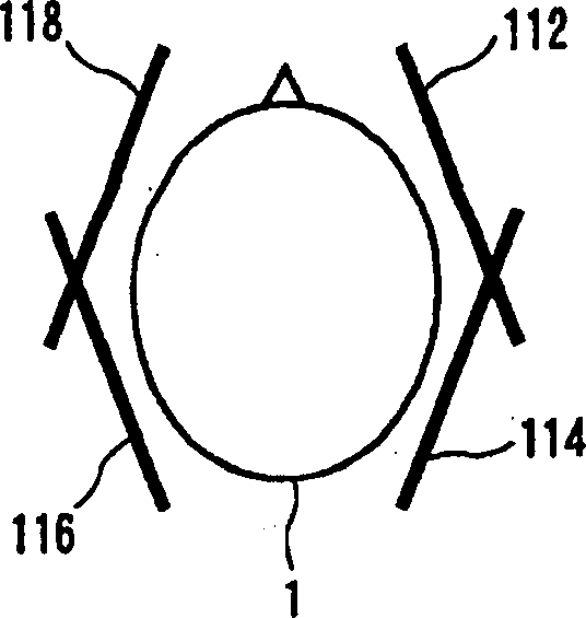 Magnetic resonance imaging equipment