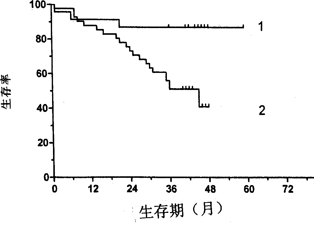 Prediction reagent kit for early stage primary liver cancer patient postoperative metastasis and recurrence based on immune molecule