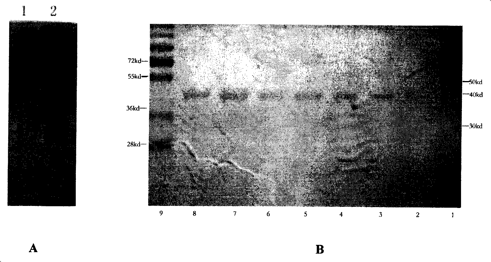 Polypeptide for preparing anti-PINK1 polyclonal antiserum and application thereof