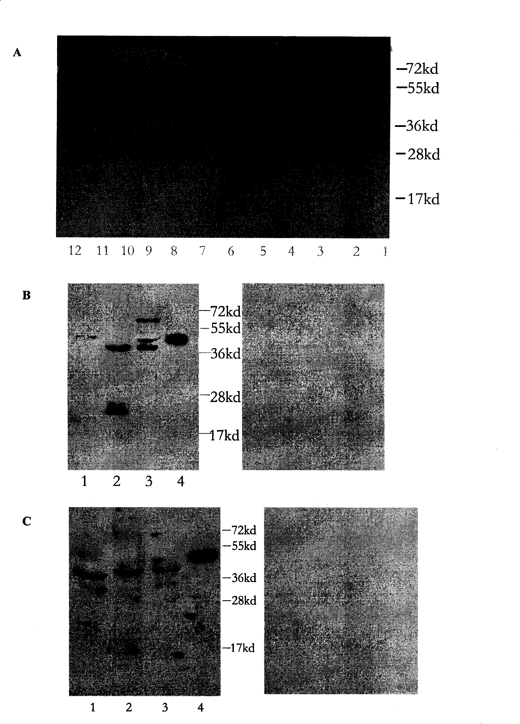 Polypeptide for preparing anti-PINK1 polyclonal antiserum and application thereof