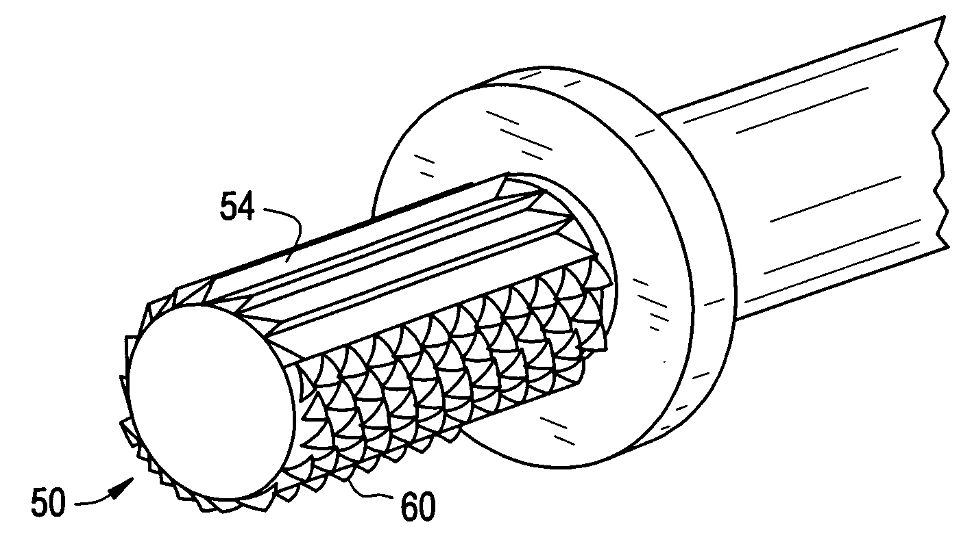 Bone removal tool