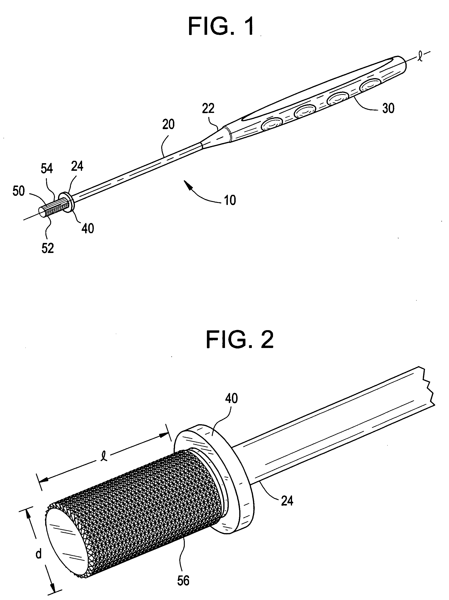 Bone removal tool