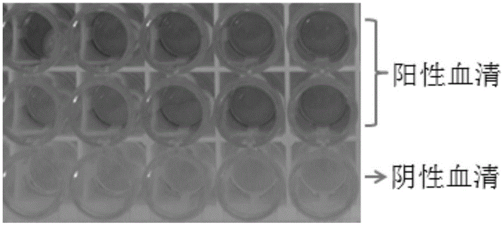 Hybridoma cell line 7D7 secreting CAV-2 monoclonal antibody, monoclonal antibody secreted by hybridoma cell line 7D7, and applications of monoclonal antibody