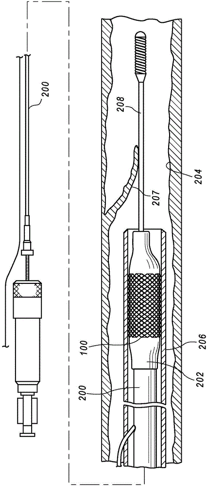 Methods for passivating metallic implantable medical devices including radiopaque markers