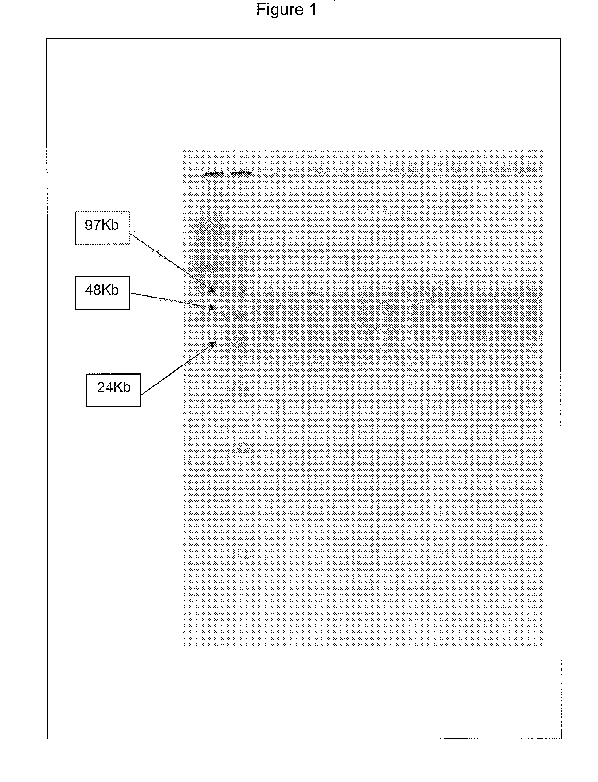 Nucleic acid purification method