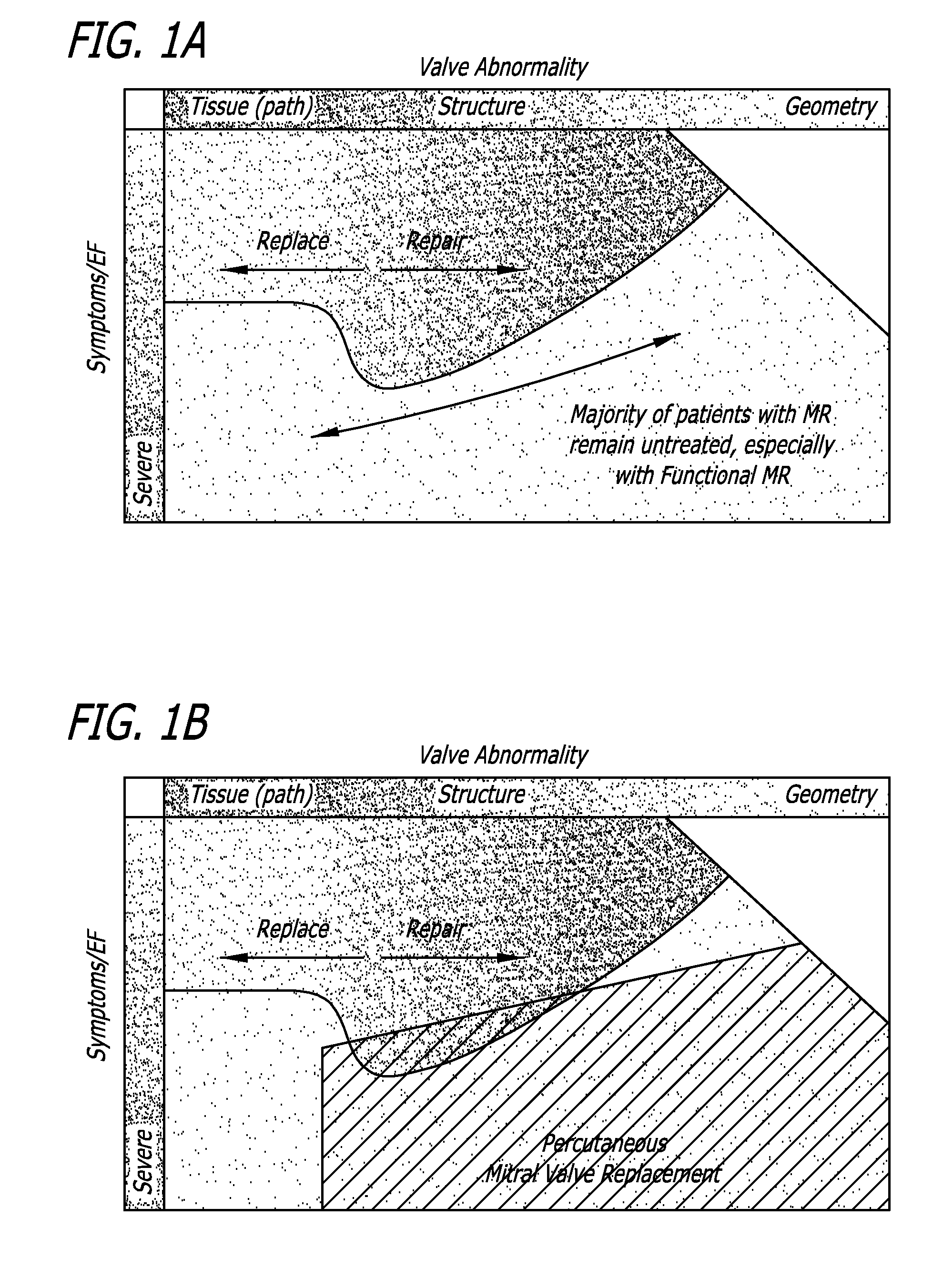 Valve replacement systems and methods