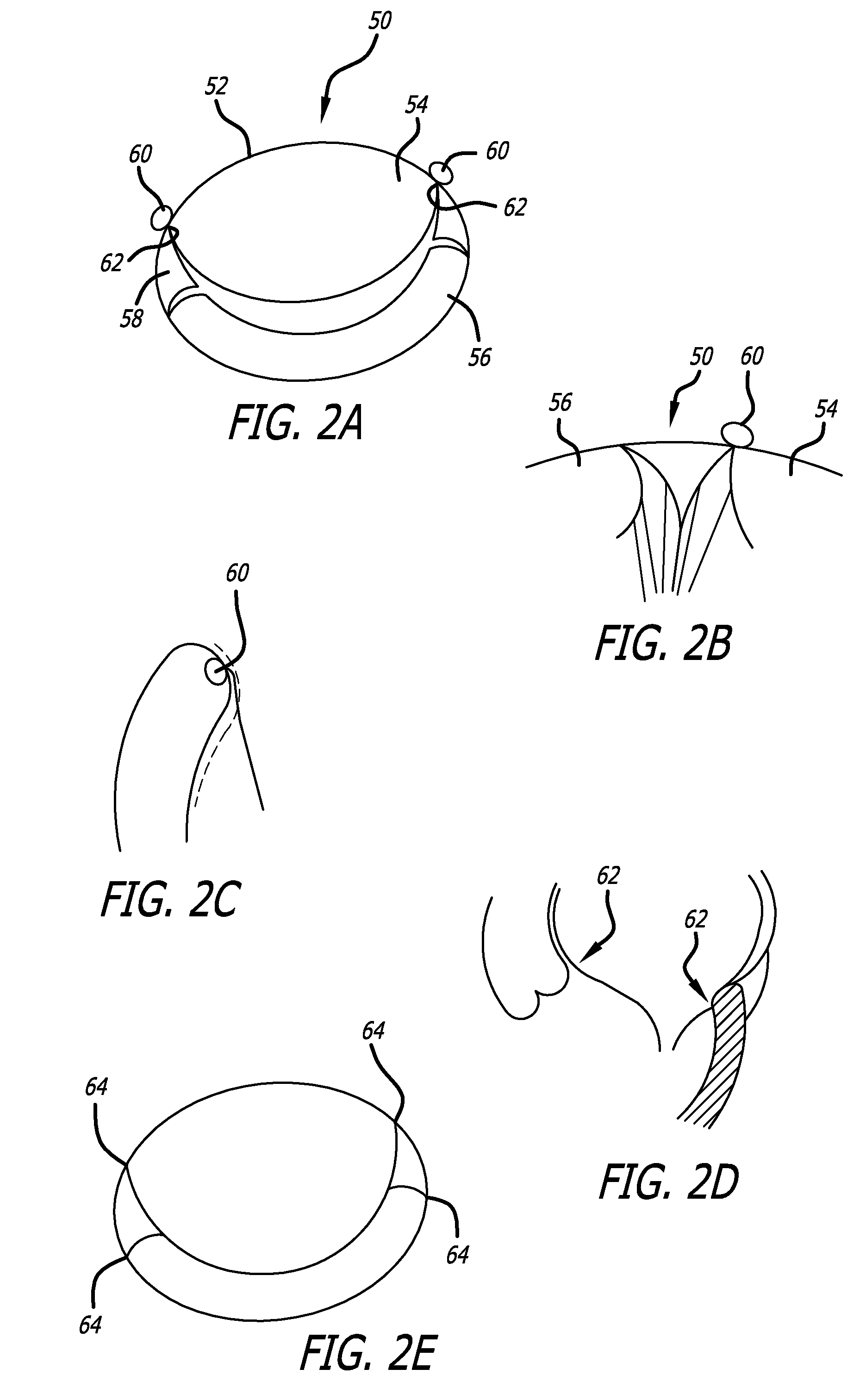 Valve replacement systems and methods