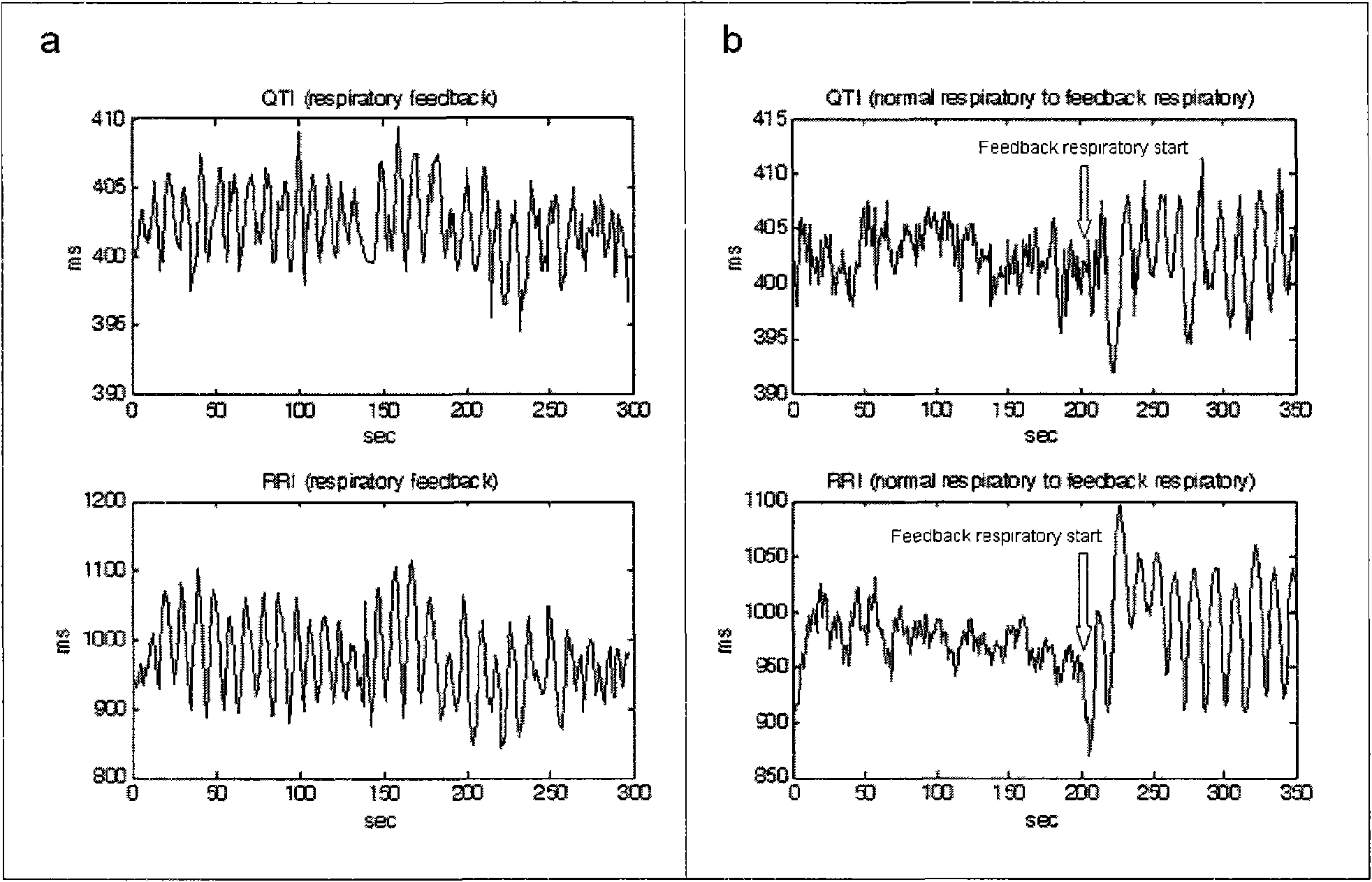 Method for building dynamic model of electrocardio signal RR interval and QT interval and applications thereof