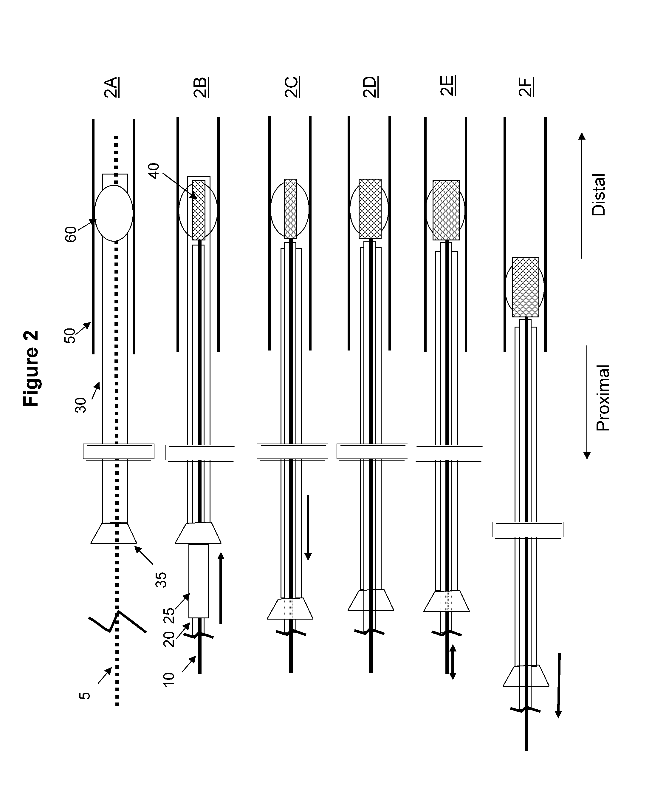 Intravascular thromboembolectomy device and method using the same