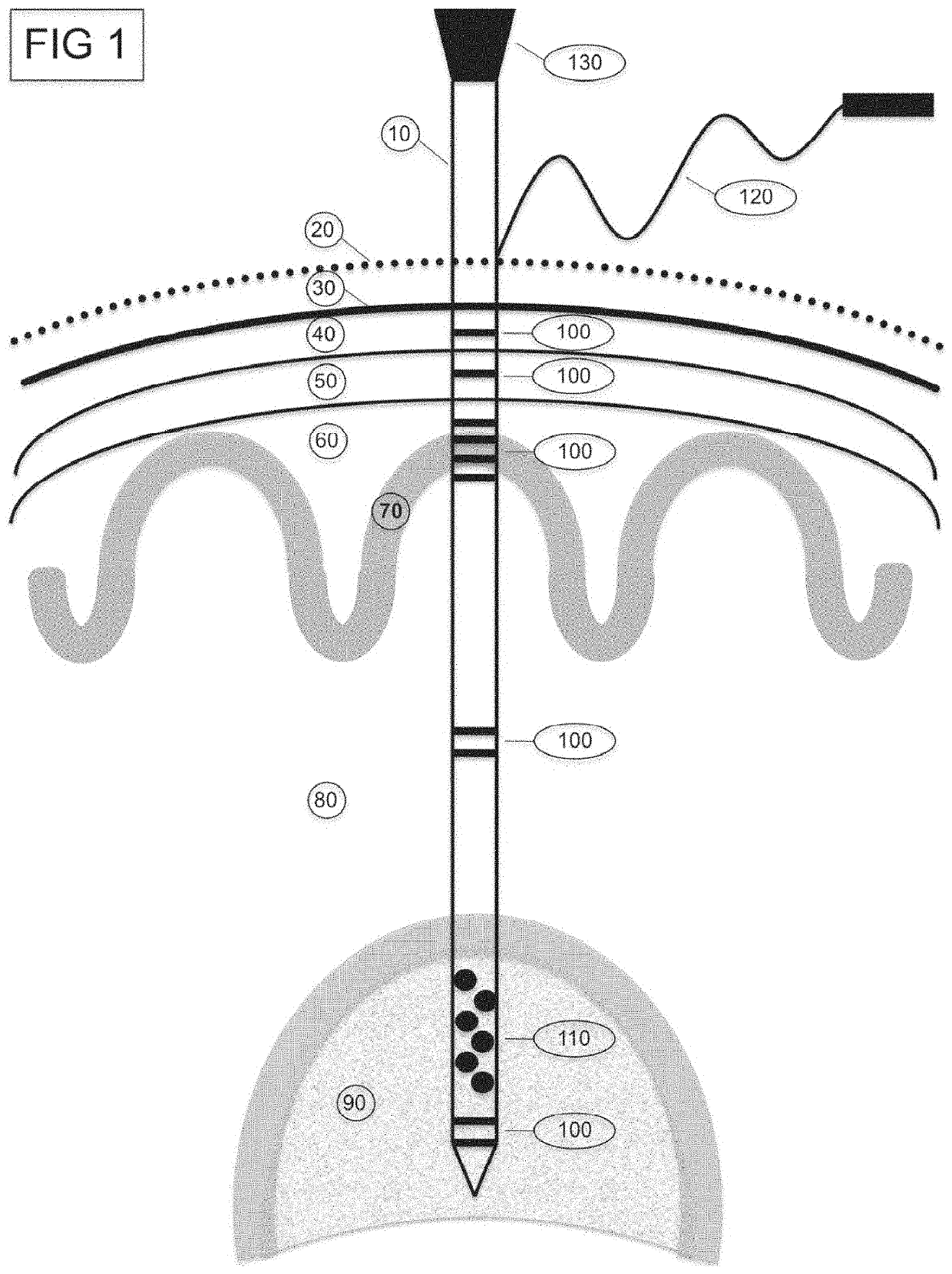 Systems and methods for positioning an intracranial device using brain activity