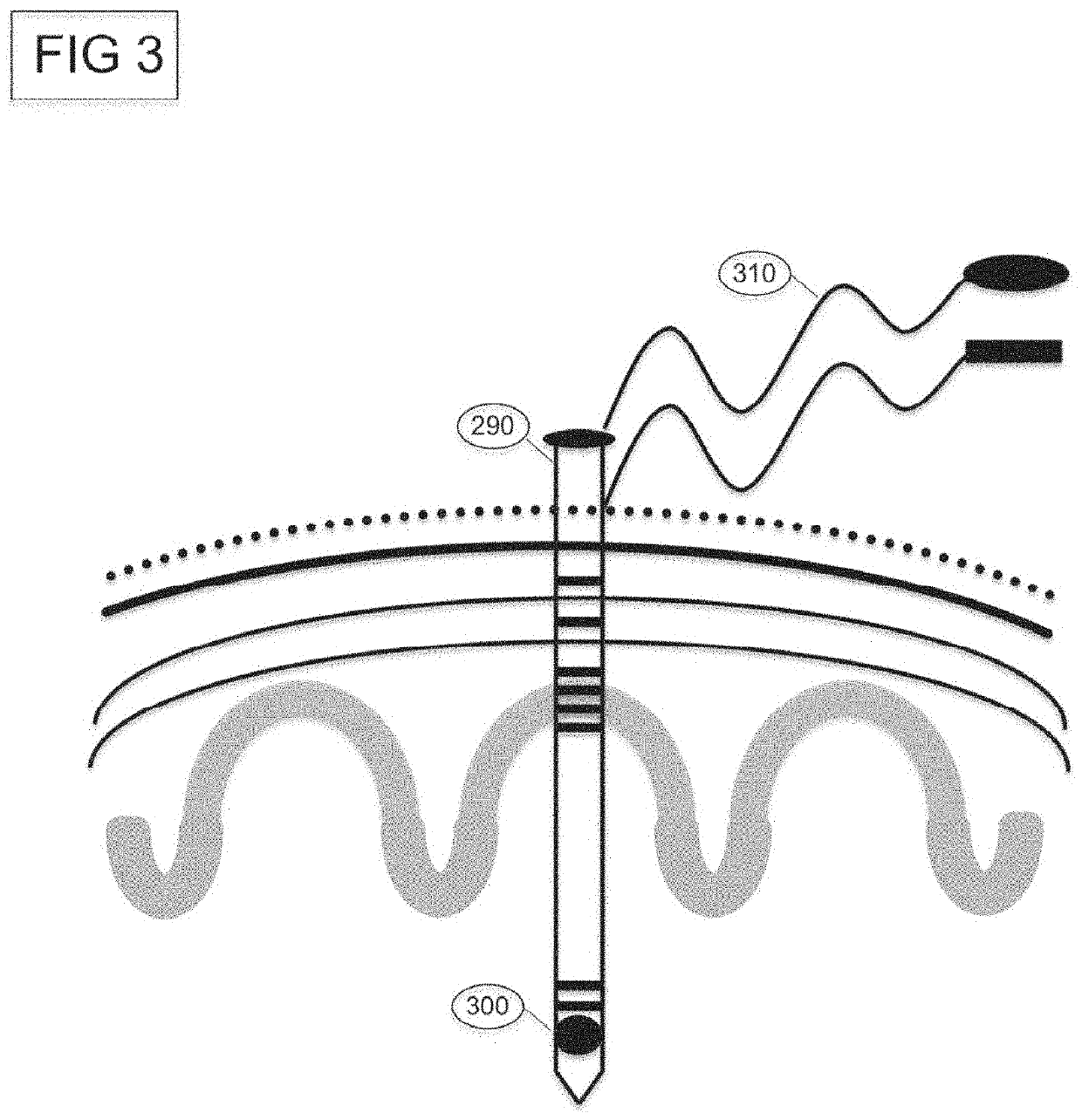 Systems and methods for positioning an intracranial device using brain activity