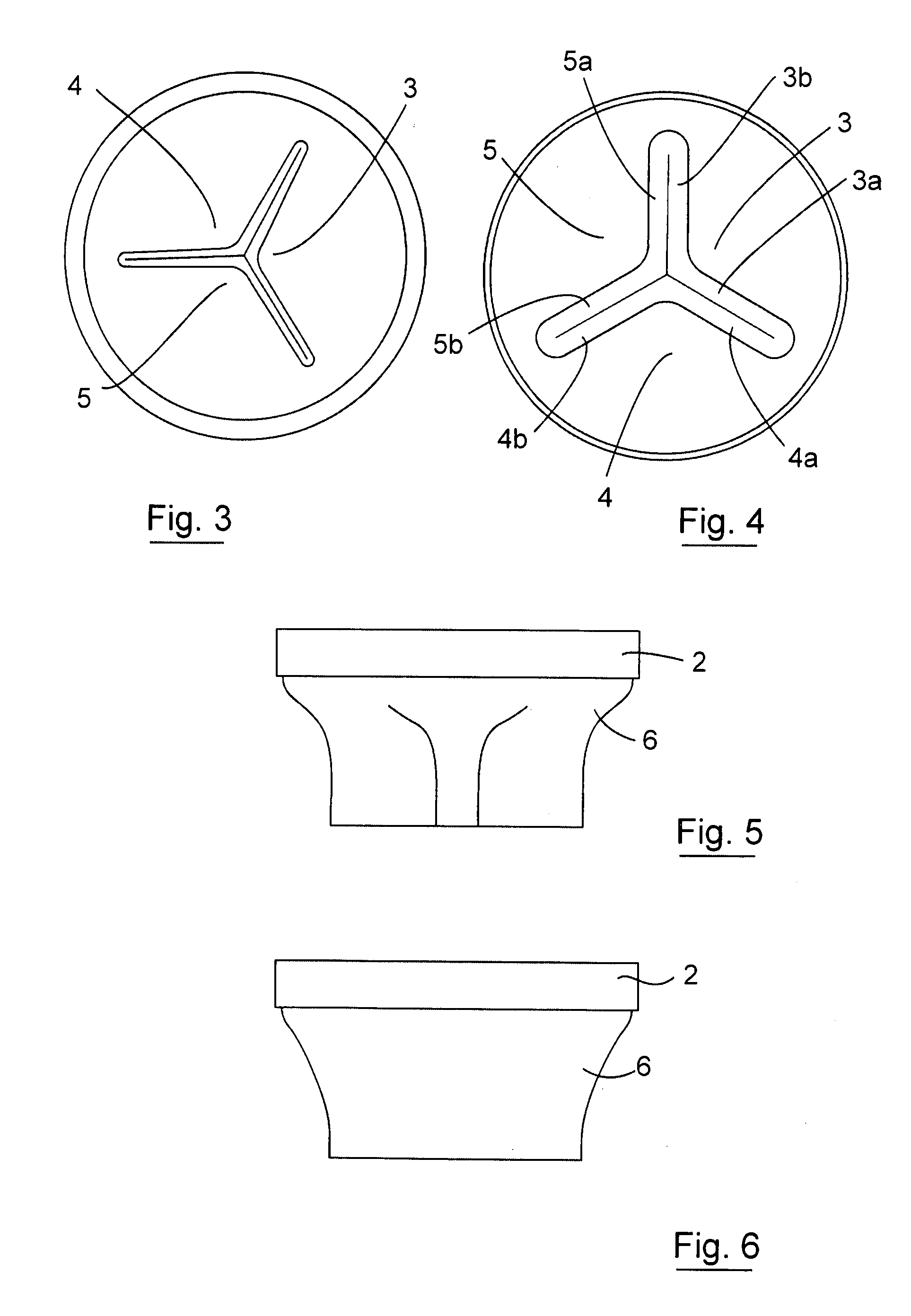 Gastrointestinal implant device