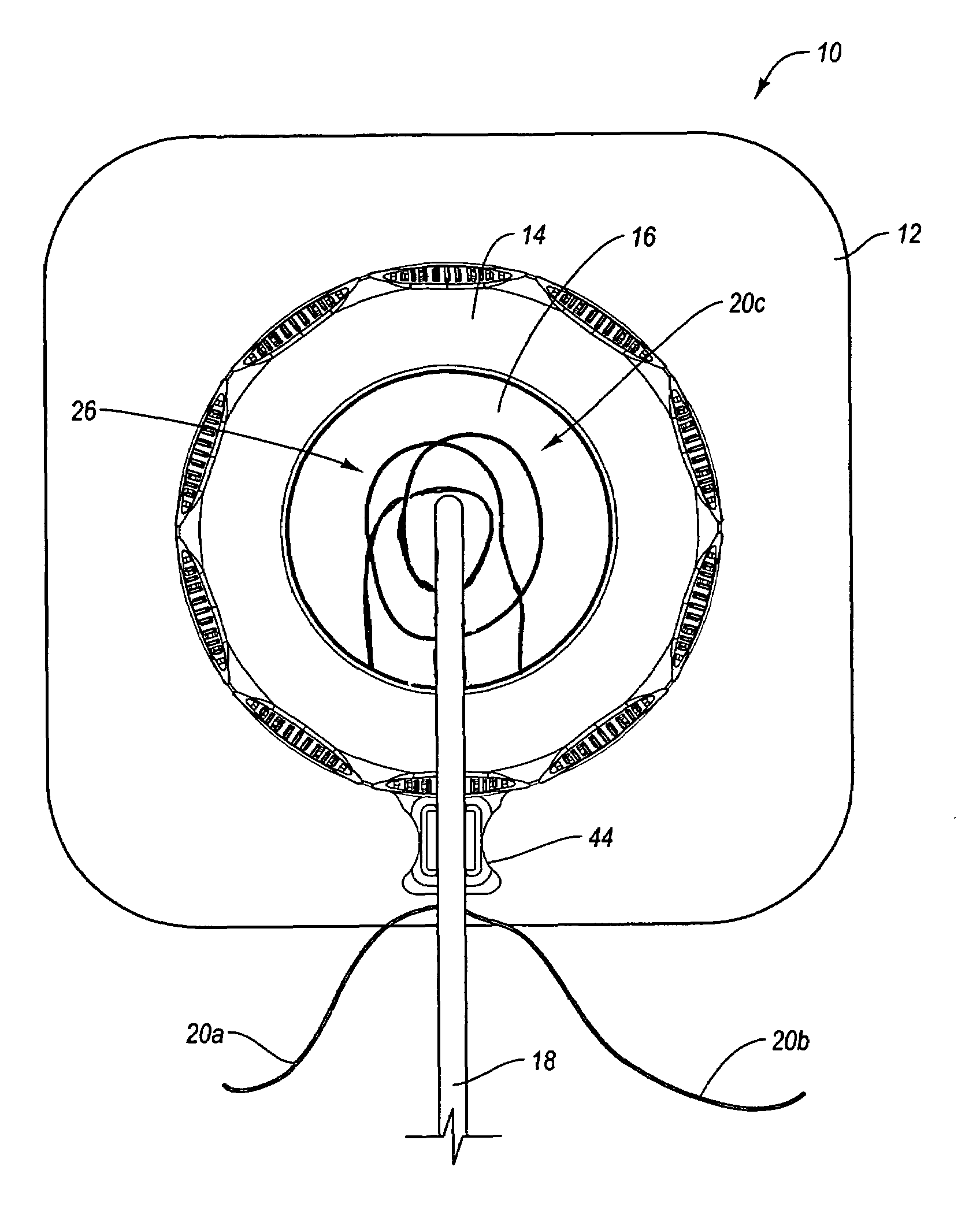 Self suturing anchor device