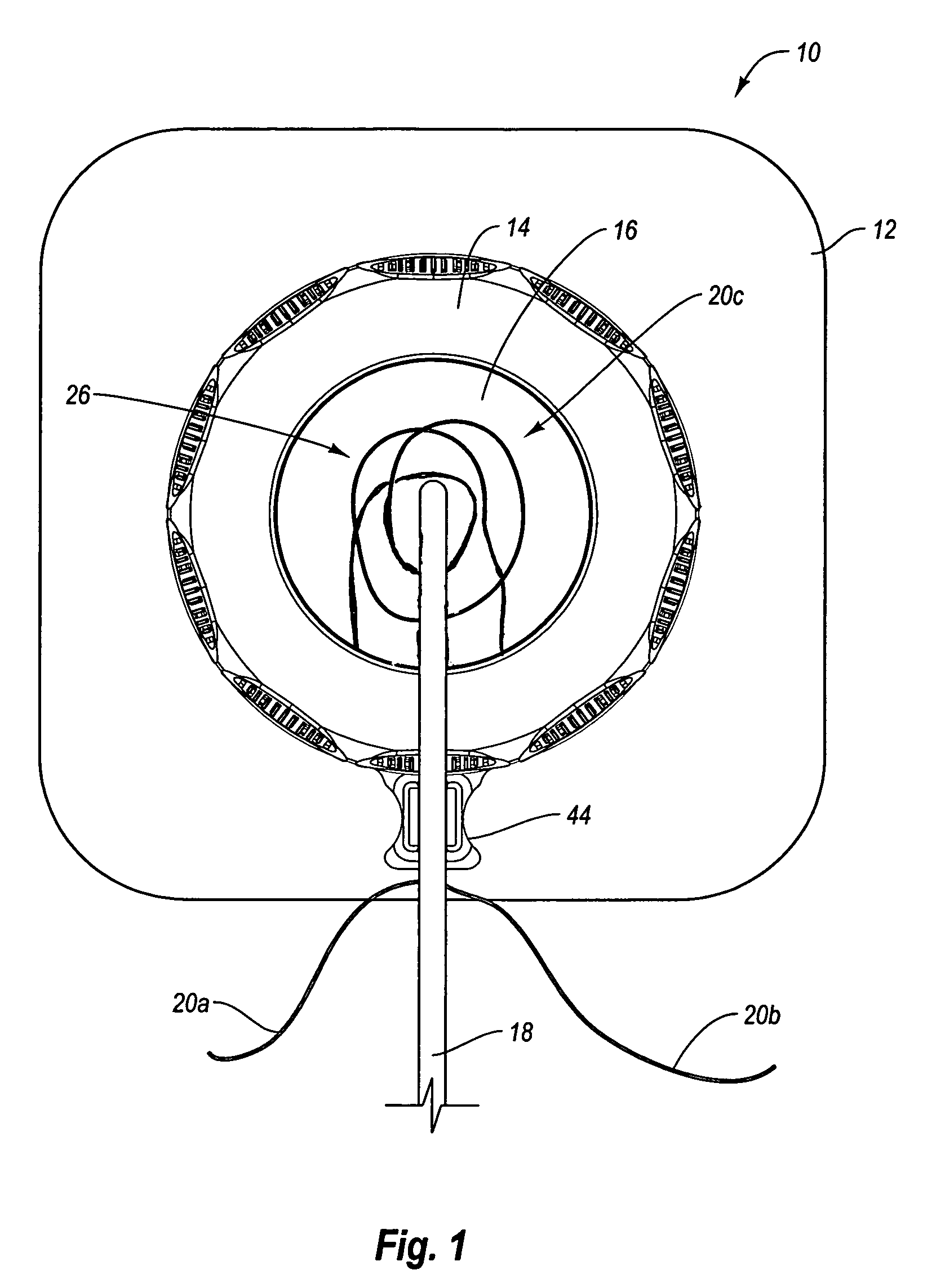 Self suturing anchor device