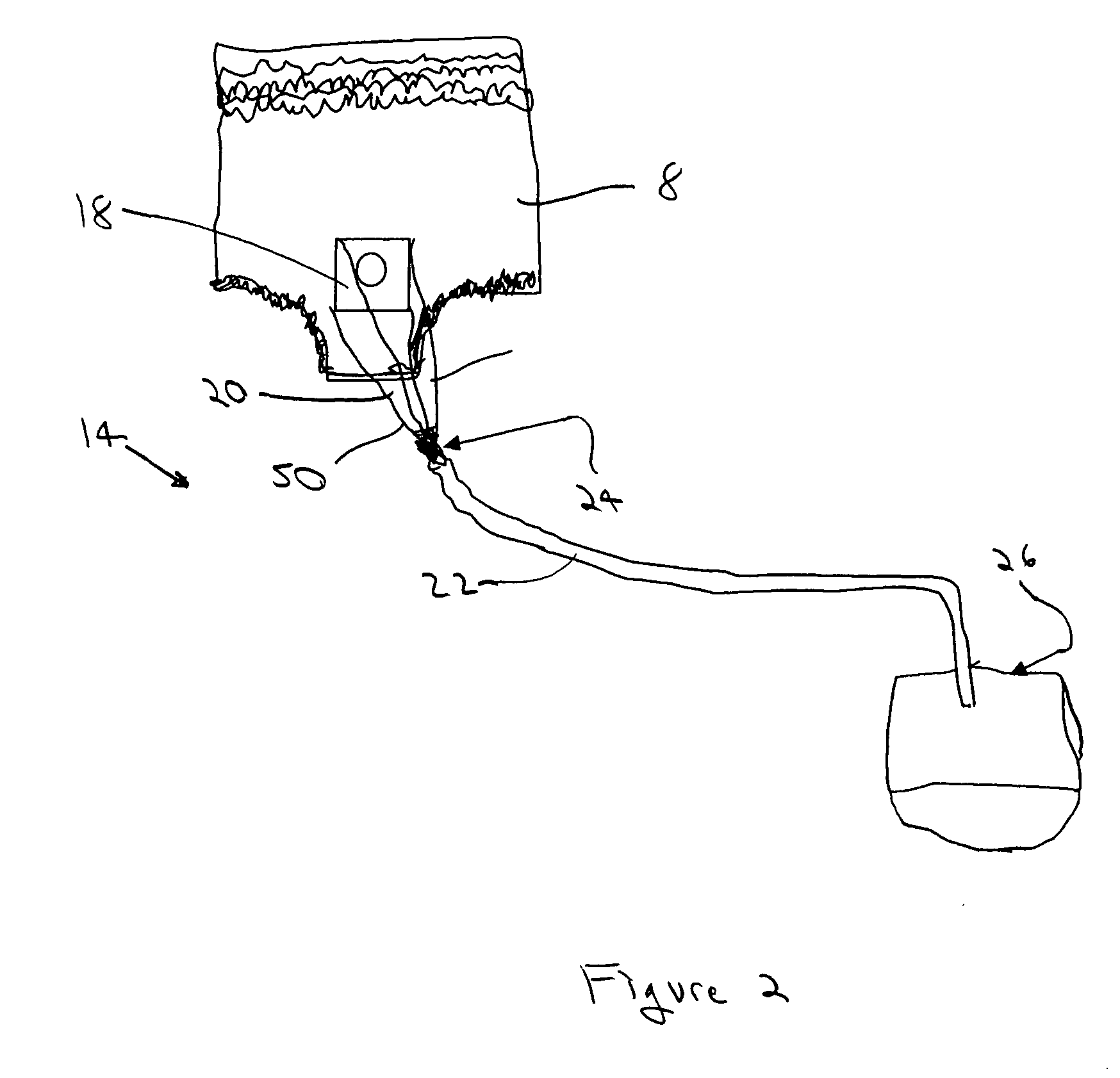 Adult male disposable incontinence system for disposable underwear