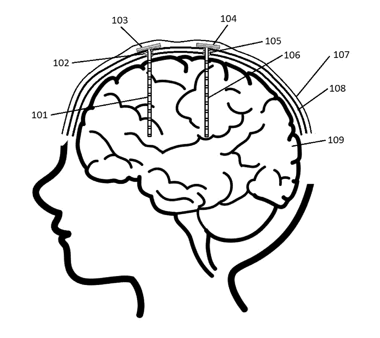 Eeg recording device