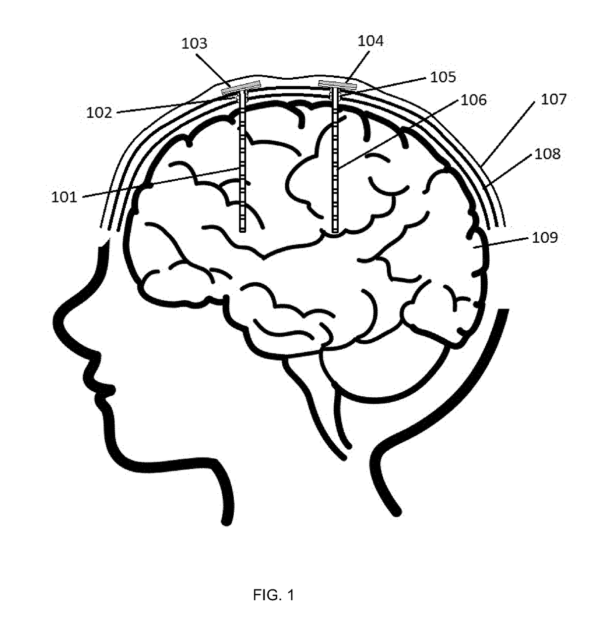 Eeg recording device