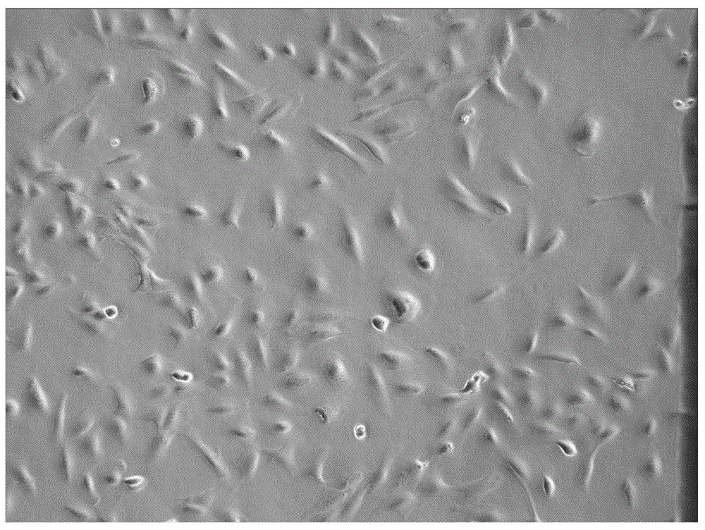 Screening method for anti-tumor medicine biomarker and application of anti-tumor medicine biomarker