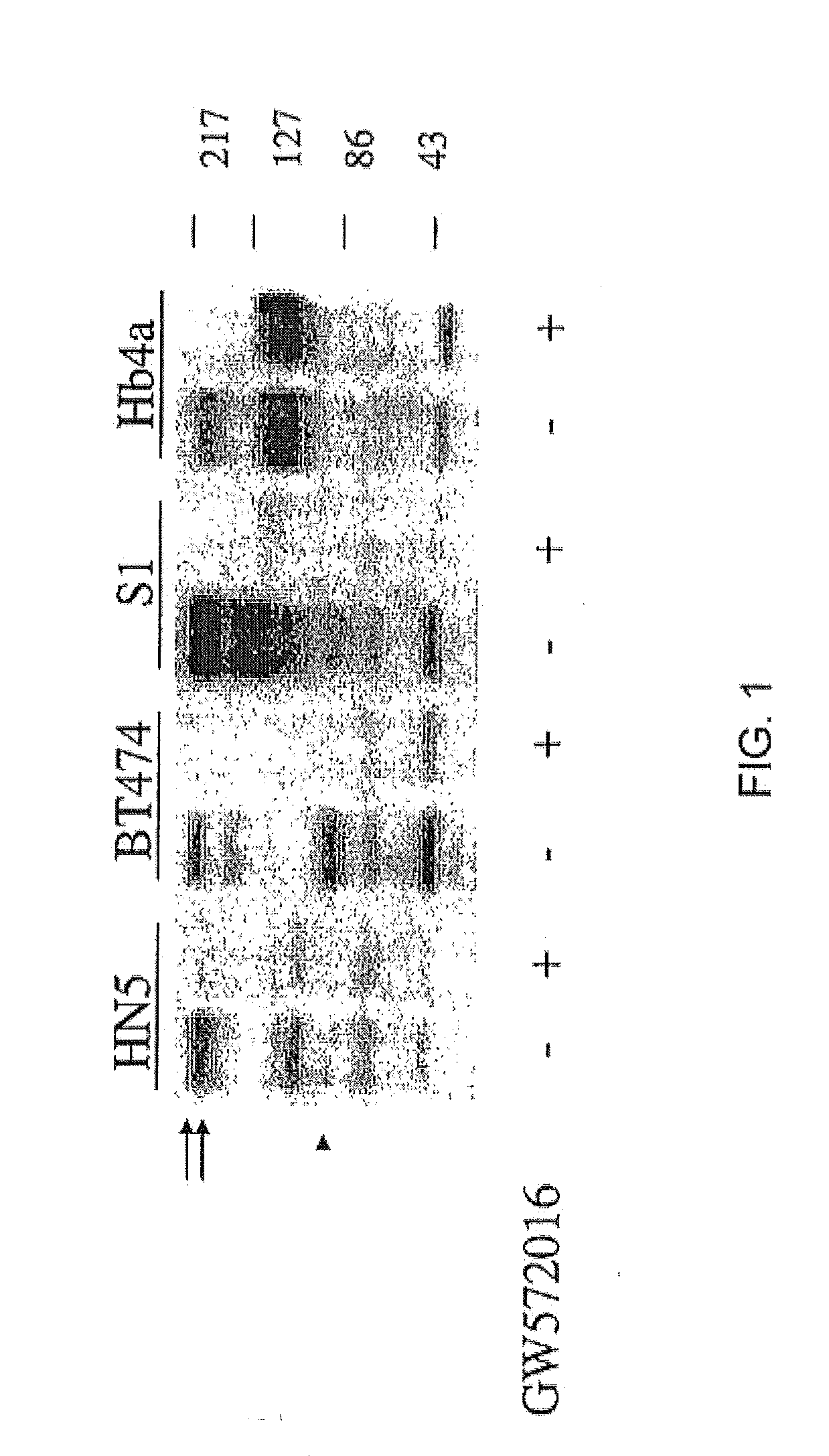 Treatment of Cancers Expressing p95 ErbB2