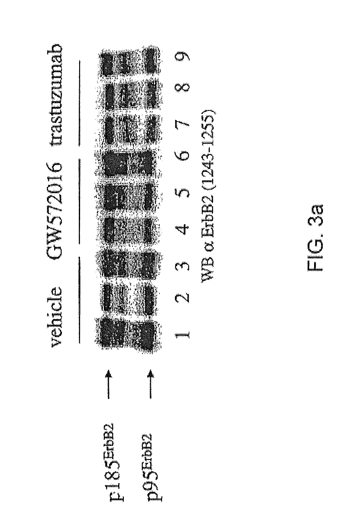 Treatment of Cancers Expressing p95 ErbB2