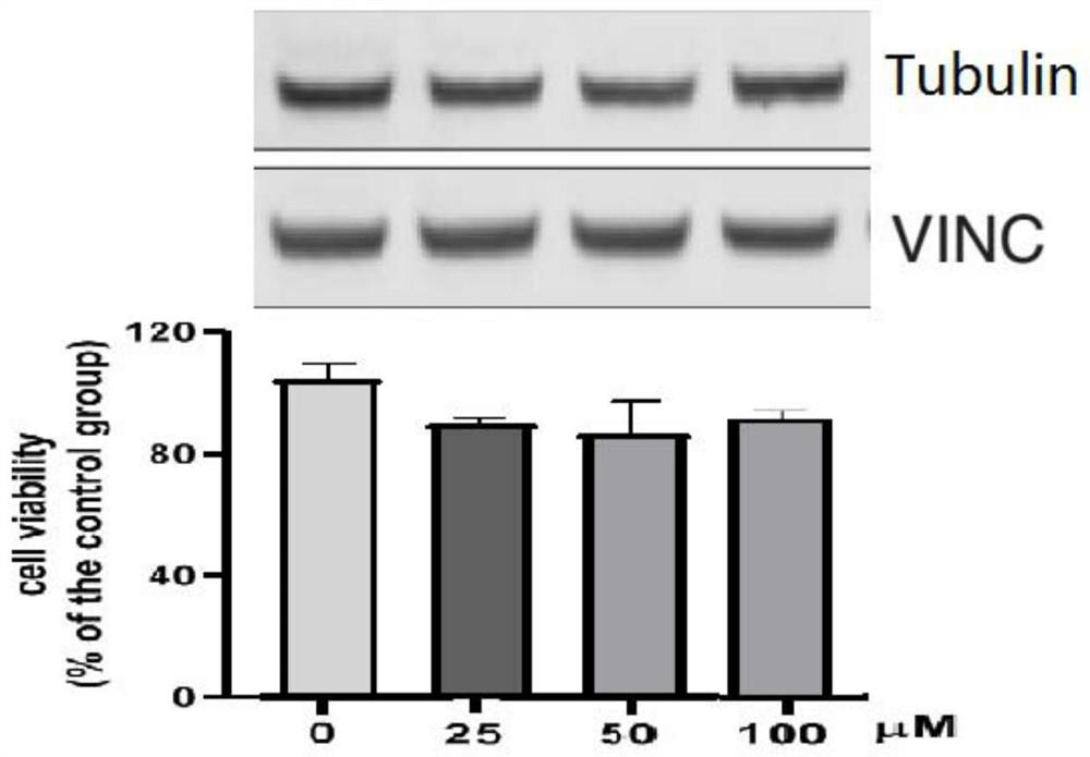 Azo compound for degrading tubulin as well as synthesis method and application of azo compound