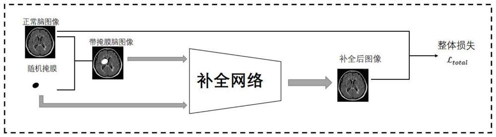 Tumor image brain region segmentation method and system based on image completion