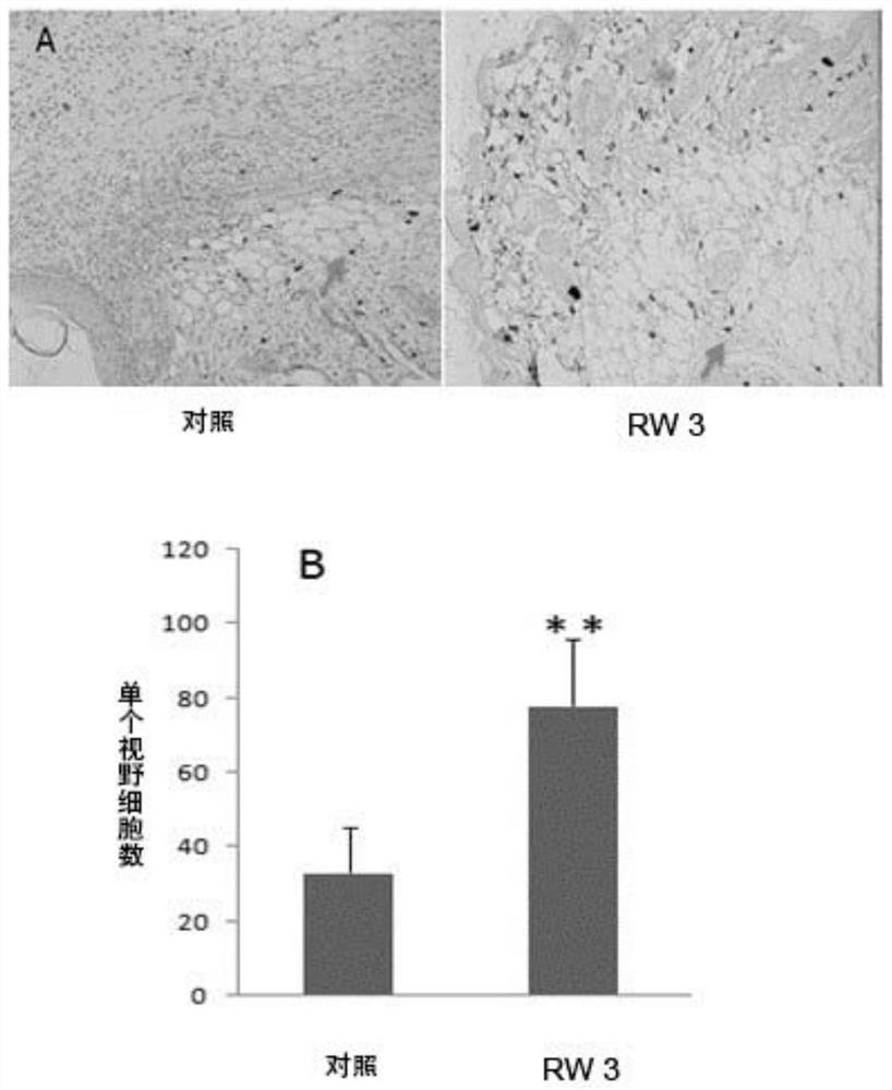 Polypeptide for promoting skin repair and application thereof