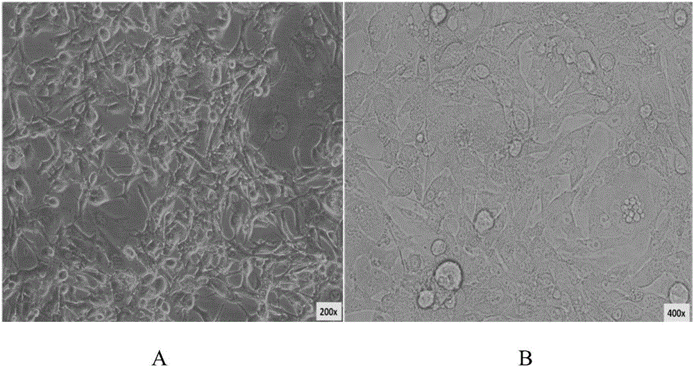 Hepatoma cell line STL-C1 derived from human hepatoma a-carcinoma tissue and establishment method thereof