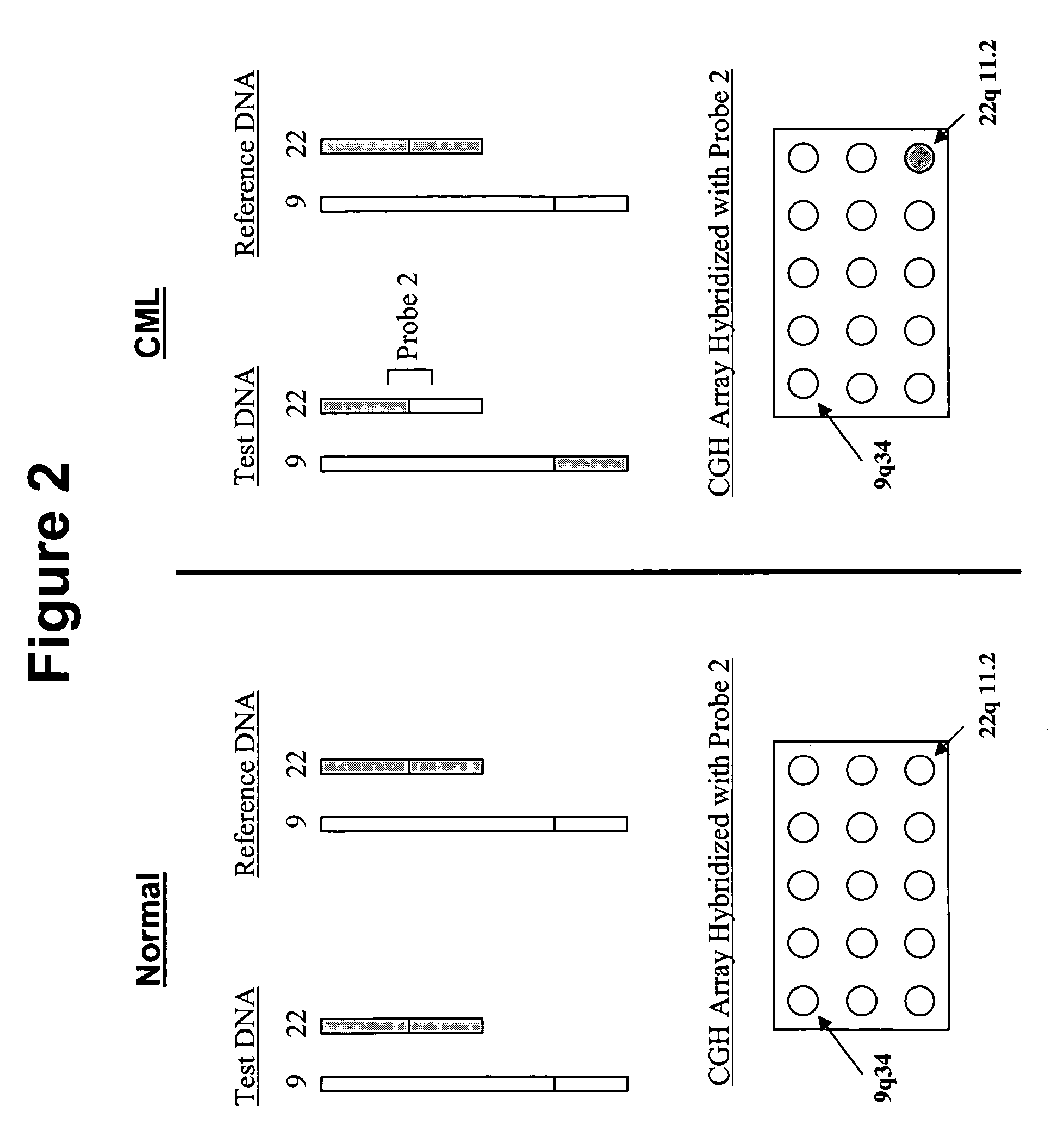 Balanced translocation in comparative hybridization