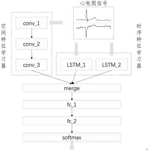 Automatic diagnosis method for electrocardiographic abnormality