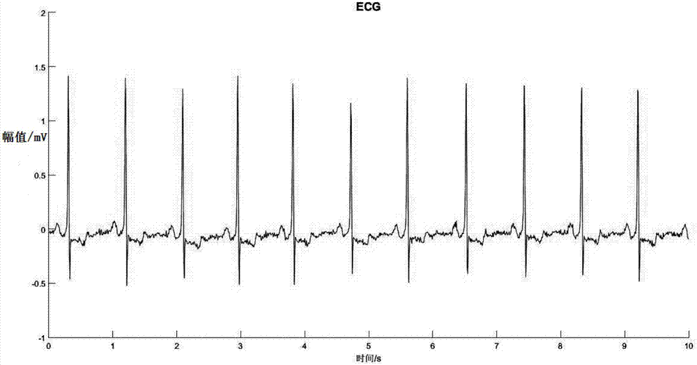 Cardiac disease risk pre-warning system and method based on deep learning algorithm