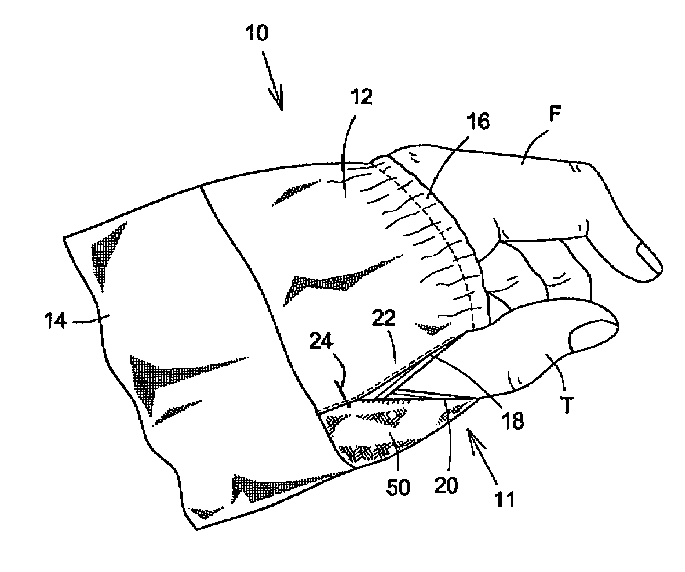 Garment element with an access opening