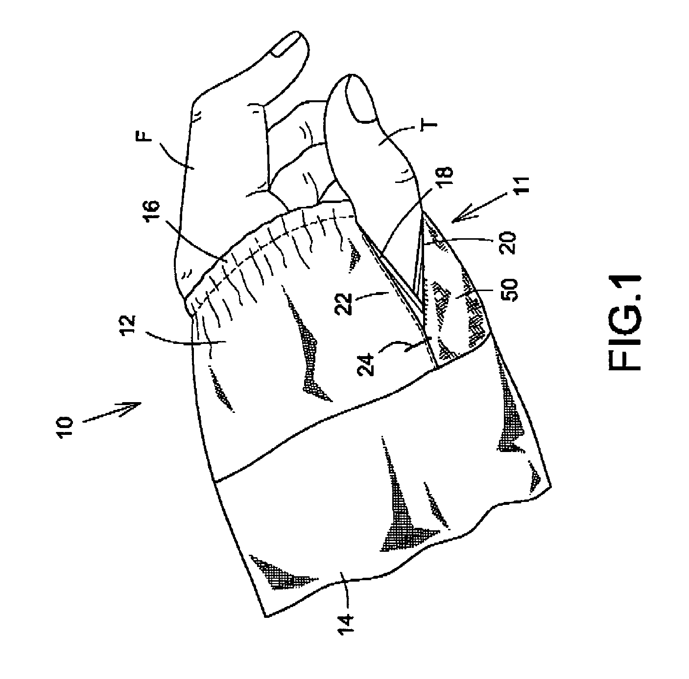 Garment element with an access opening