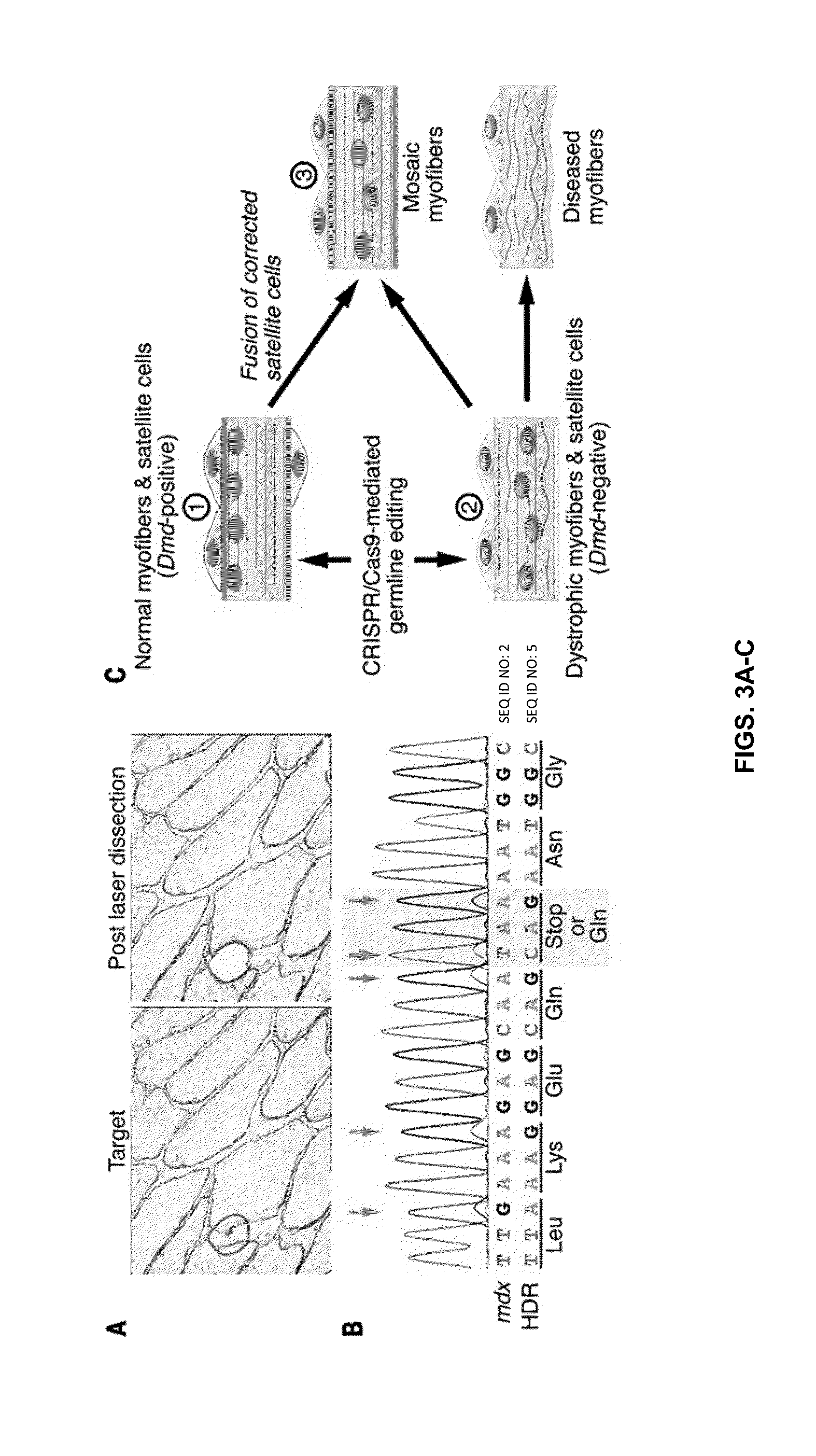 Prevention of muscular dystrophy by crispr/cas9-mediated gene editing