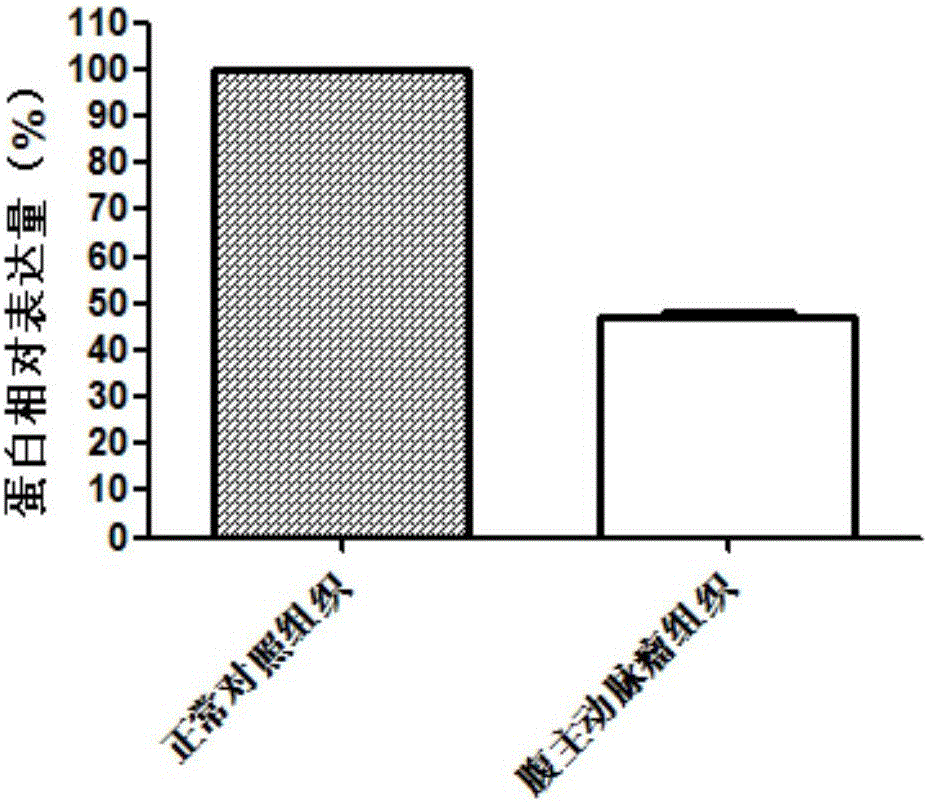 Application of SPHAR (S-phase response) as diagnosis and treatment target for abdominal aortic aneurysm