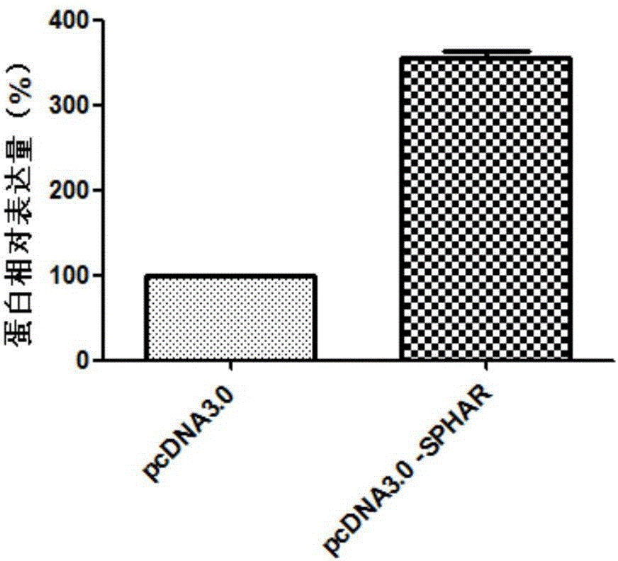 Application of SPHAR (S-phase response) as diagnosis and treatment target for abdominal aortic aneurysm