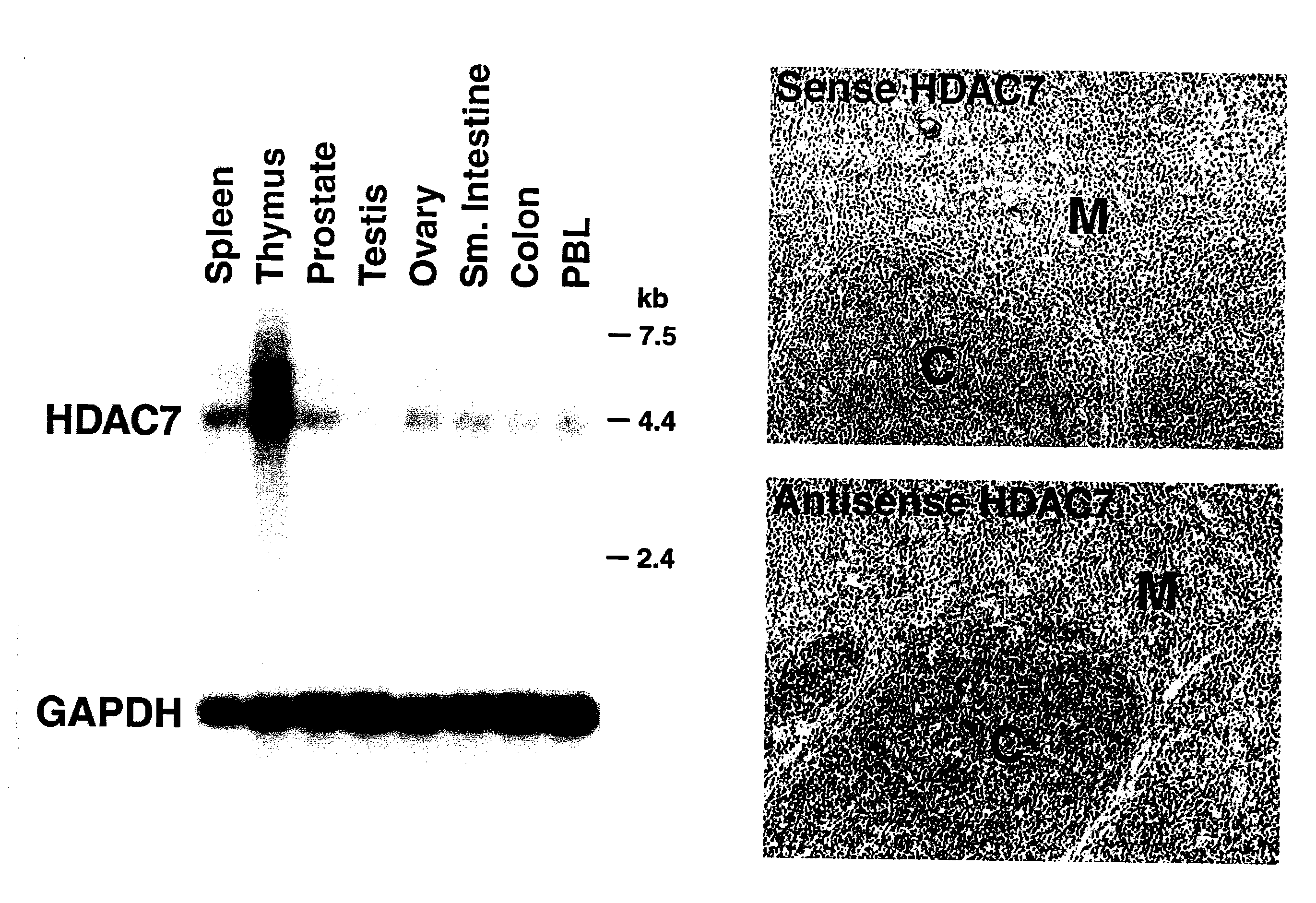 Dephosphorylation of HDAC7 By Myosin Phosphatase