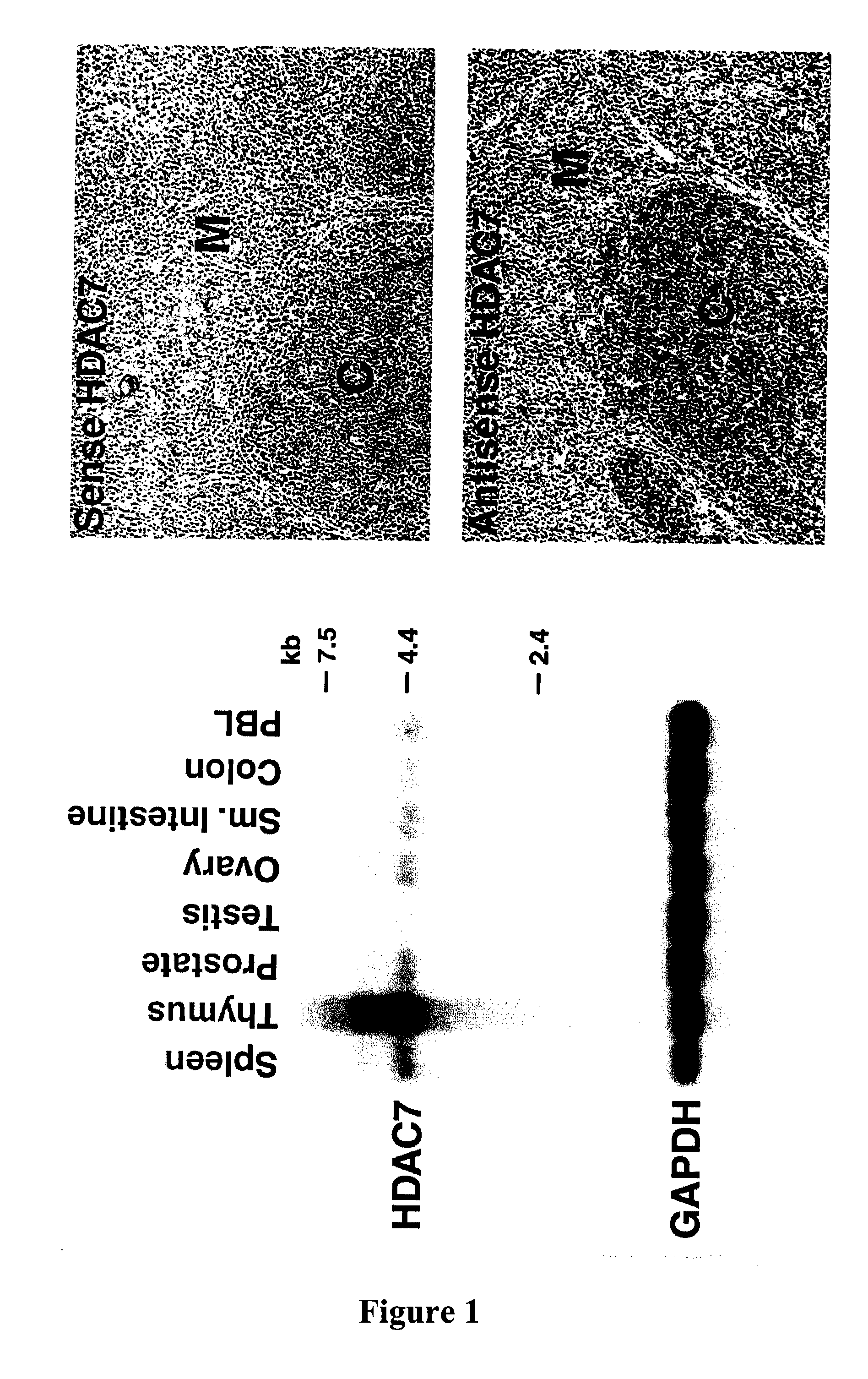 Dephosphorylation of HDAC7 By Myosin Phosphatase